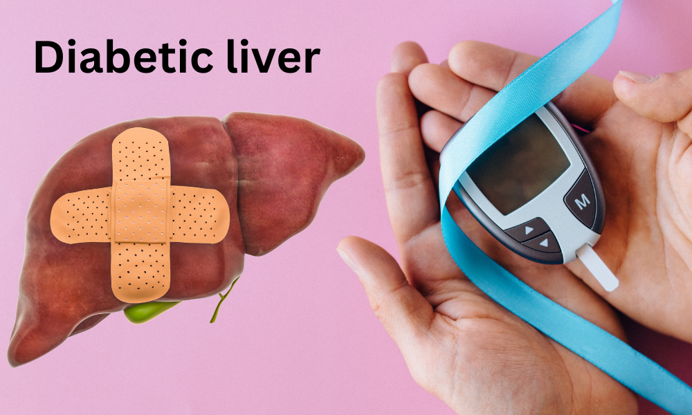 Diabetes Liver: How High Blood Sugar Harms Your Liver